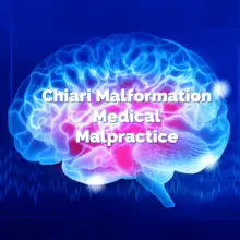 Chiari Malformation Medical Malpractice Verdict - Jonathan C. Reiter Law Firm