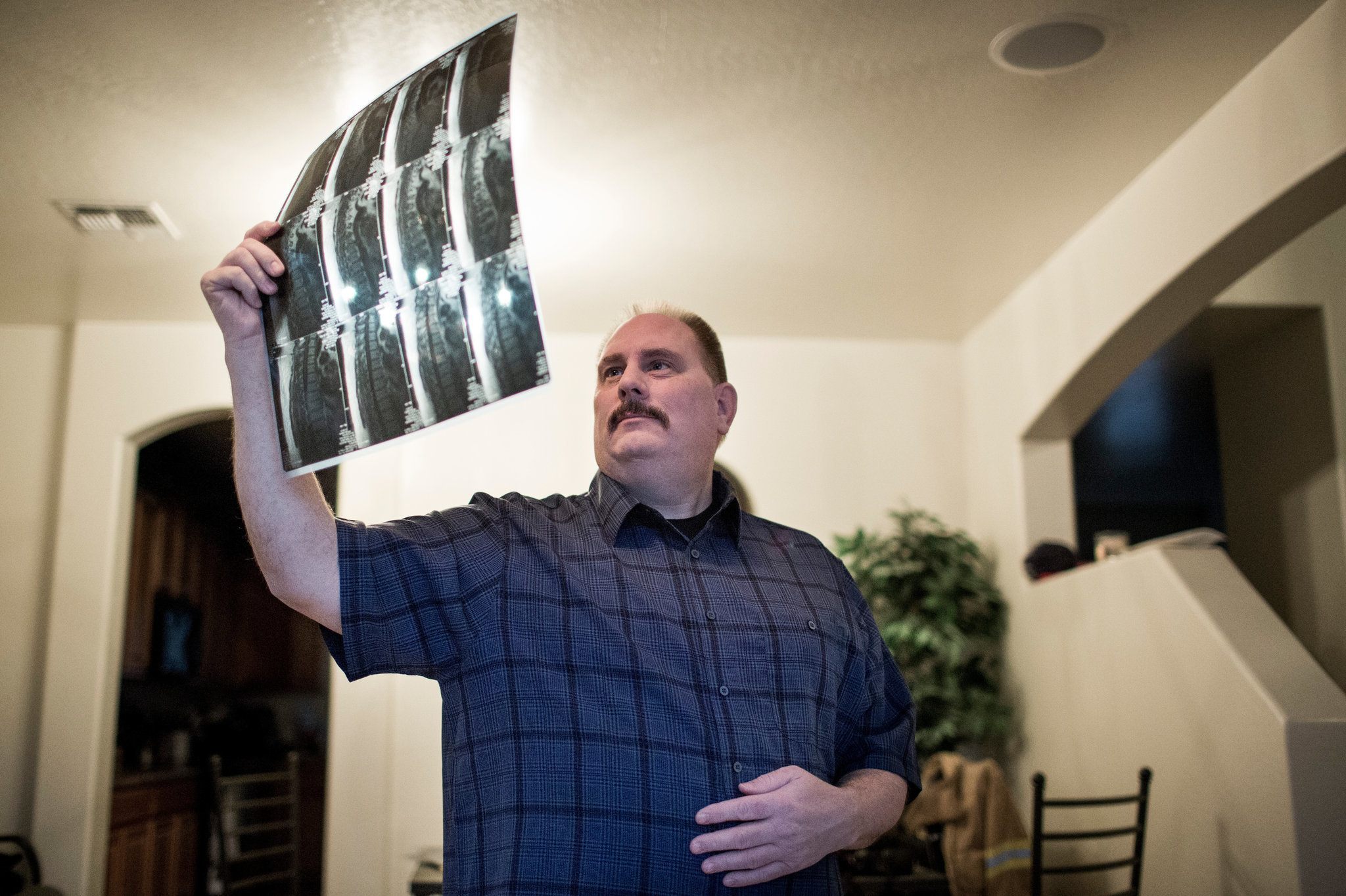 Aaron Chamney, a former Rural/Metro fire captain, at his home in Avondale, Ariz. He said he could no longer work because of severe rib and chest pain from injuries he sustained on the job.