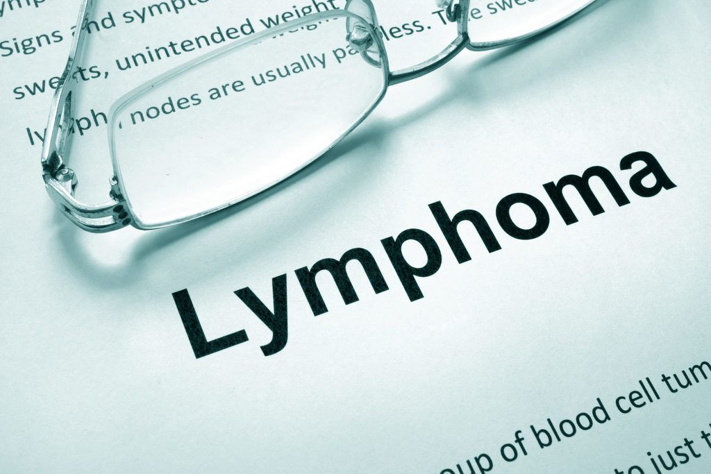 Elocution Lymphoma Nyc Reference: Misdiagnosis Of Lymphoma