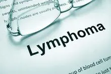 Talk to an NYC Medical Malpractice Lawyer About Your Misdiagnosis of Lymphoma